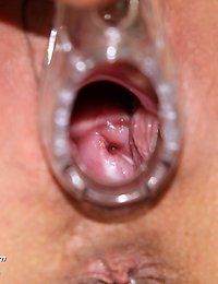 Venuse  elder kinky nurse cunt plastic penis masturbation on gynochair