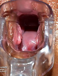Sara extreme cum-hole speculum gaping at gynecology room by skilled practitioner