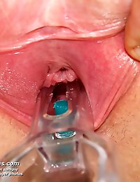 Deviated nurse Candie masturbating with large plastic schlong and medical instrument at gyno clinic
